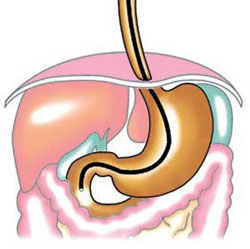 Gastroscope-diagram